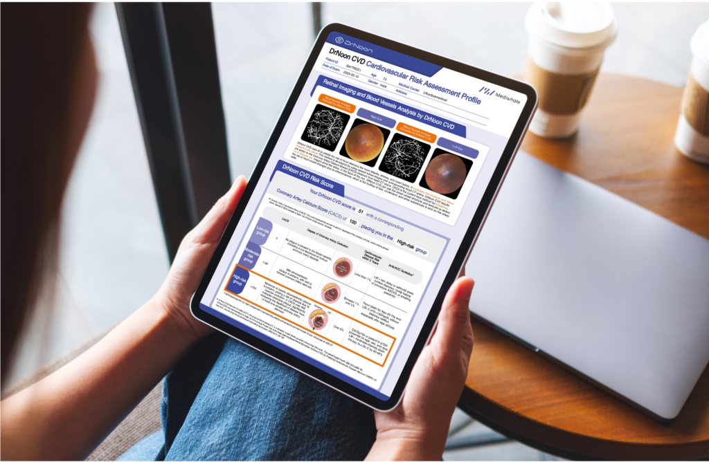 Introducing Heart‑Eye Screening: A New Window Into Your Cardiovascular Health